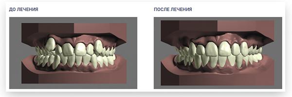 Как Star Smile за 6 лет покорила 5 стран изображение 6